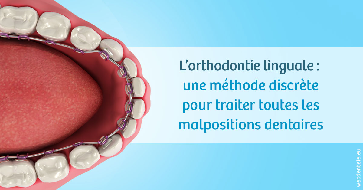 https://dr-ghadimi.chirurgiens-dentistes.fr/L'orthodontie linguale 1