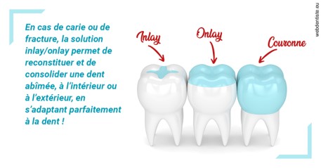 https://dr-ghadimi.chirurgiens-dentistes.fr/L'INLAY ou l'ONLAY