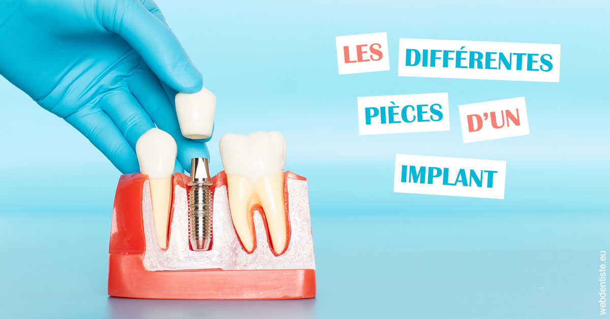 https://dr-ghadimi.chirurgiens-dentistes.fr/Les différentes pièces d’un implant 2