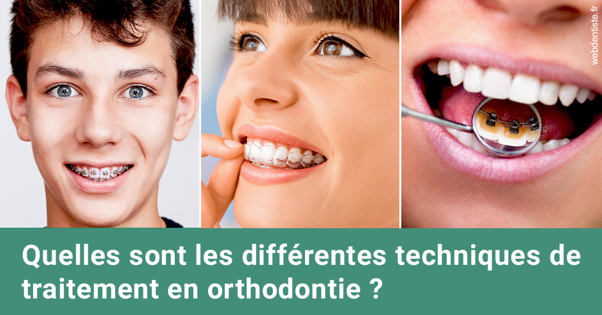 https://dr-ghadimi.chirurgiens-dentistes.fr/Les différentes techniques de traitement 2