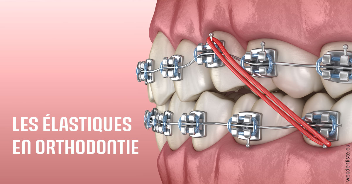 https://dr-ghadimi.chirurgiens-dentistes.fr/Elastiques orthodontie 2