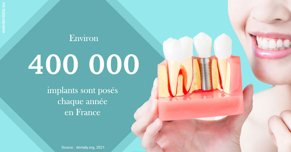 https://dr-ghadimi.chirurgiens-dentistes.fr/Pose d'implants en France 2